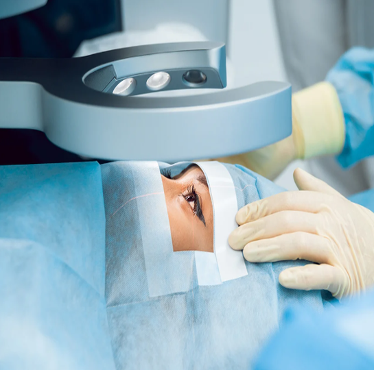 Cataract Surgery