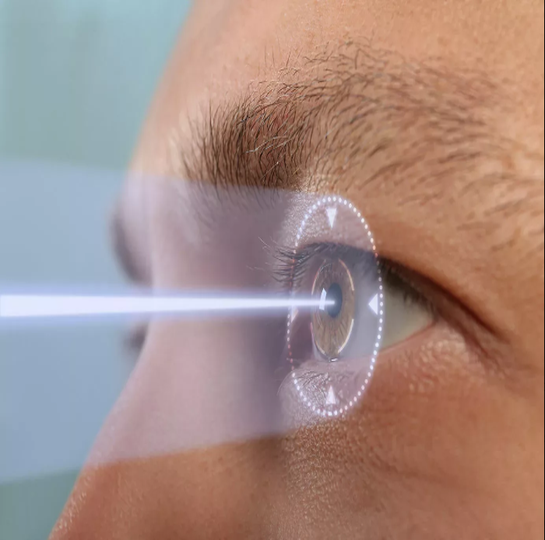 Lasik treatment